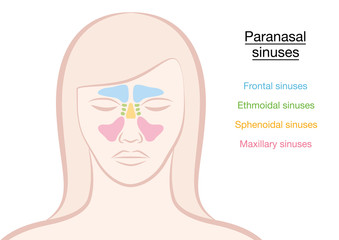Paranasal sinuses on a womans face in different colors - frontal, ethmoidal, sphenoidal and maxillary sinuses. Isolated vector illustration on white background.
