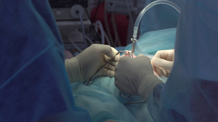 Obraz na płótnie Canvas Operation using laparoscopic equipment. Surgeons team. Hospital.