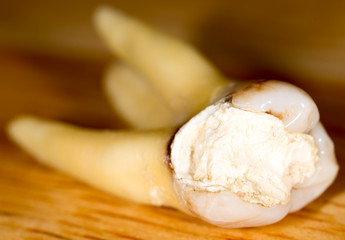 tooth torn. macro