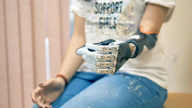 An amputee woman demonstrates her bionic hand. 4K.