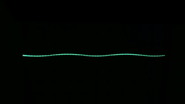 Amplitude Diagram on the oscilloscope