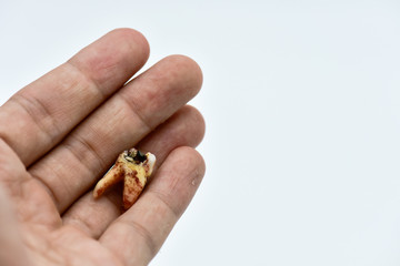 Tooth decay dental caries on hand, The Molar Fracture on white Background