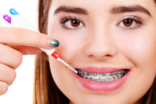 Woman brushing teeth with braces using brush