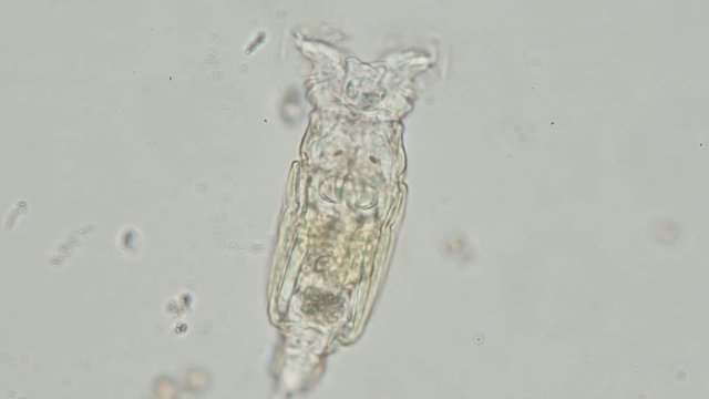 Rotifers are microscopic aquatic animals of the phylum Rotifera. Rotifers can be found in many freshwater environments and in moist soil.