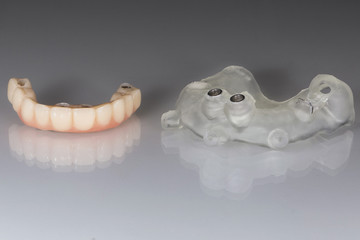 ceramic teeth and a template for the operation