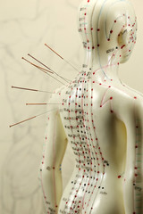 female acupuncture model with needles in the shoulder - obrazy, fototapety, plakaty