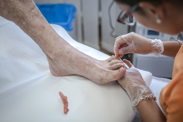 medico podologo cura piede paziente anziano - obrazy, fototapety, plakaty
