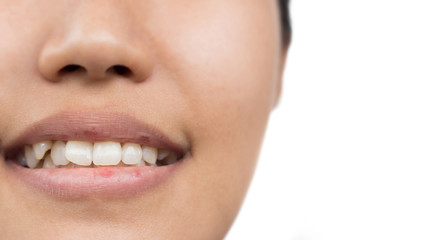 Women with oral health problems
