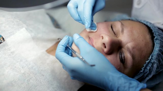 The procedure for mechanical cleansing of the face in the area of the lips