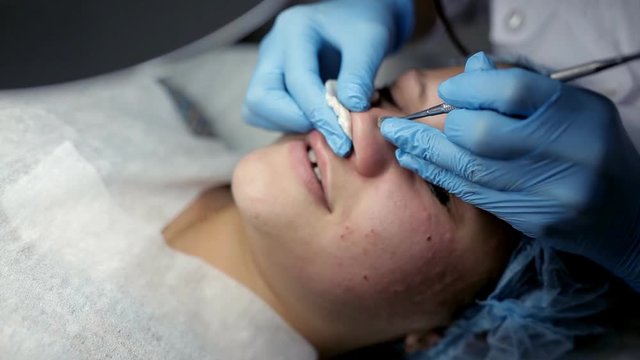 The beautician makes a cleansing of the nose area during the procedure of mechanical facial cleansing
