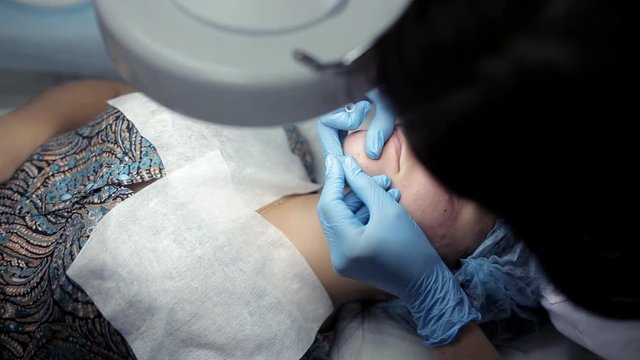 The beautician pierces the needle with the needle on the girl's face. The procedure of mechanical face cleaning