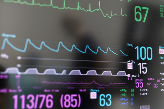 Closeup photo of EKG monitor