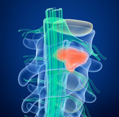 Spinal cord under pressure of bulging disc, 3D illustration