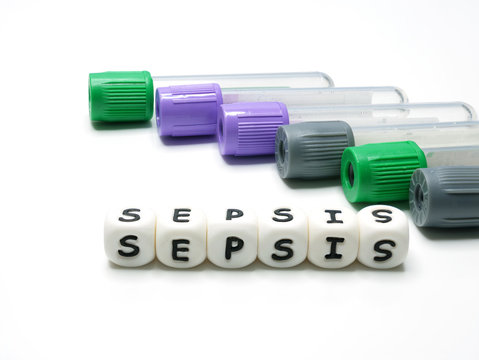 test tubes with many color caps