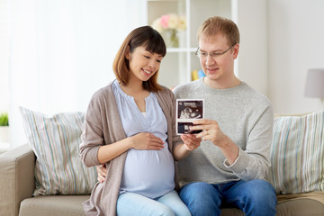 Obraz premium happy couple with ultrasound images at home