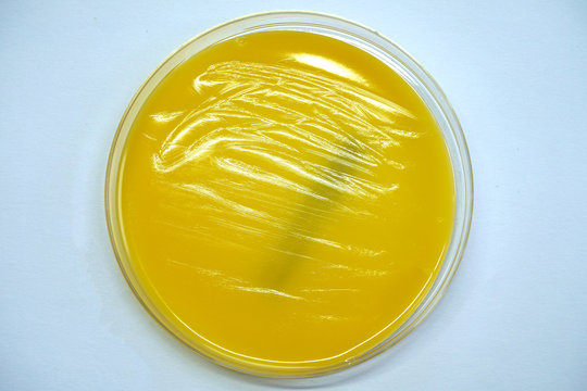 MRSA test clean petri dish.