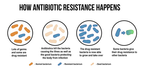 How antibiotic resistance happens diagram - obrazy, fototapety, plakaty