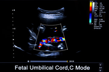 Colourful image of pregnancy ultrasound monitor