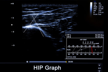 Colourful image of modern ultrasound monitor