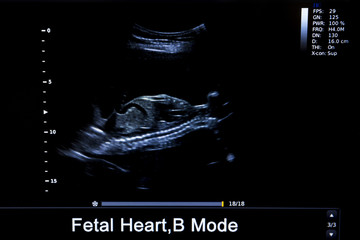 Colourful image of pregnancy ultrasound monitor