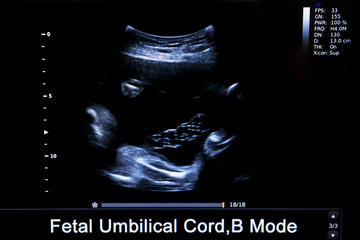 Colourful image of pregnancy ultrasound monitor