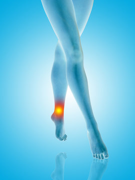 Conceptual beautiful woman or girl legs and feet with a hurt ankle pain or ache closeup, 3D illustration of human slim fit body medical or health care concept, painful sport injury on blue background