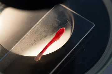 Background Fischoederius elongates is an important trematode of Paramphistomes in ruminants. 