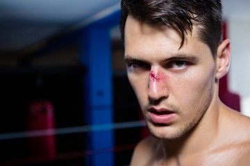 Close-up portrait of young male boxer with bleeding nose