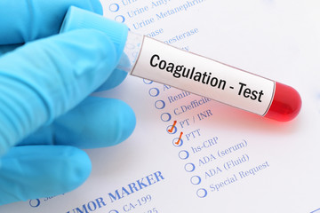 Blood sample with requisition form for coagulation test
