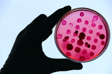 Scientist's hand in white lab coat and blue glove holding an opened Petri dish (plate) loaded with red agar Endo. Escherichia coli and other enterobacteria colonies.  Blue sly  background, backlight.