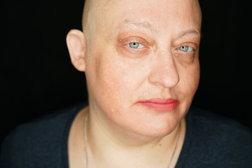 portrait of a bald woman