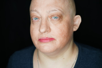 portrait of a bald woman