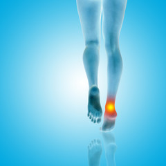 Conceptual beautiful woman or girl legs and feet with a hurt ankle pain or ache closeup, 3D illustration of human slim fit body medical or health care concept, painful sport injury on blue background