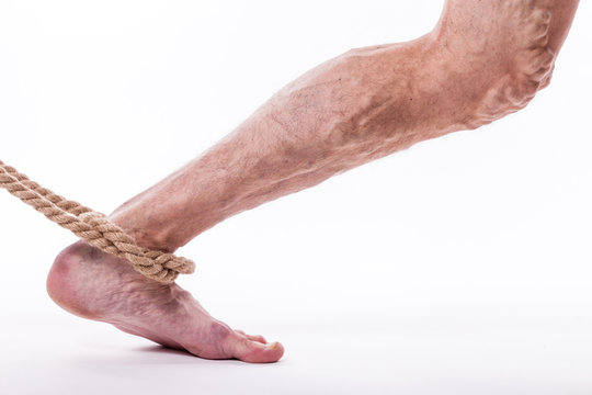 rope holding human leg ailing varicose veins of the lower extremities and venous thrombophlebitis and on a white background, with depth of field Photo