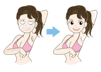 エステ・女性のムダ毛処理・ビフォーアフター