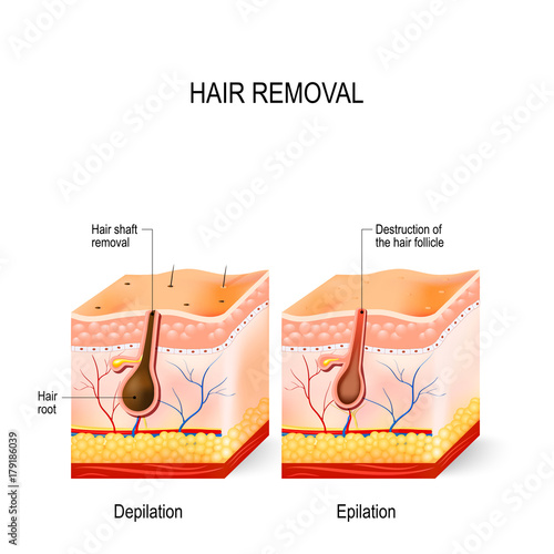 difference between epilation and depilation