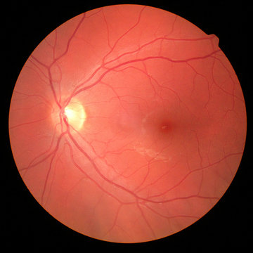 right eye's retinal image with macula, vessels and optic disc isolated view on a black bacground