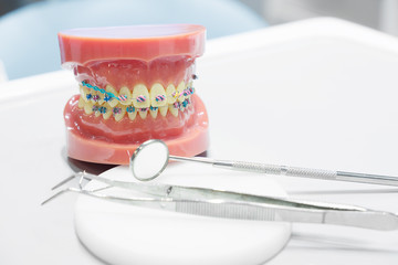 orthodontic model and dentist tool - demonstration teeth model of varities of orthodontic bracket or brace