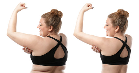 Young woman before and after weight loss on white background. Health care and diet concept