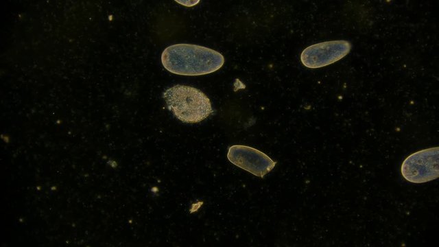 unicellular microorganism - paramecium under the microscope video clip
