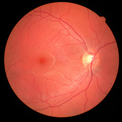 left eye's retinal image with macula, vessels and optic disc isolated view on a black bacground