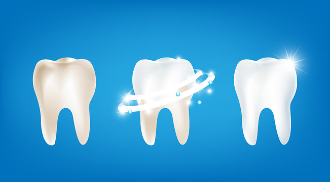 Collection of dirty clean and strong  white tooth wiht glittering bright light element on blue background