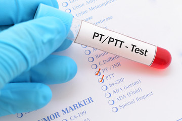 Blood sample with requisition form for PT and PTT test, diagnosis for blood coagulation
