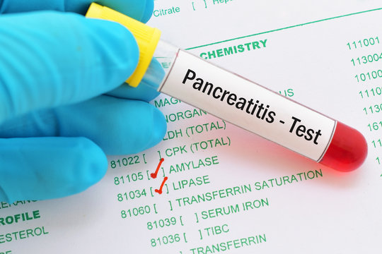 Blood sample with requisition form for pancreatitis test
