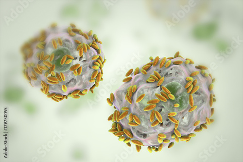 Microscopic Diagnosis Of Bacterial Vaginosis Vaginal Secretions Contain 