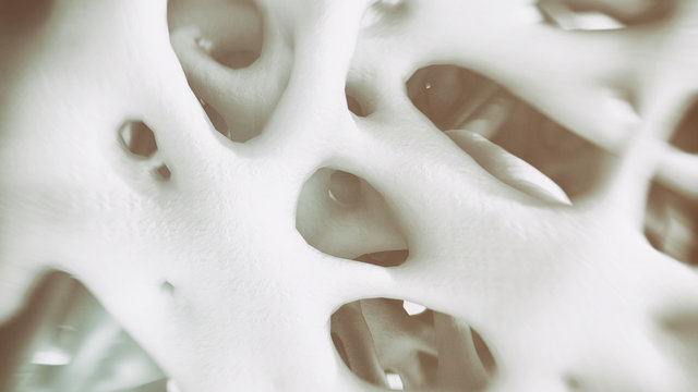 Osteoporosis -look into the bone - 3d rendering