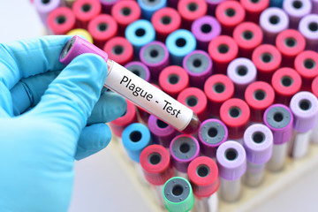Fototapeta premium Blood sample for plague disease test
