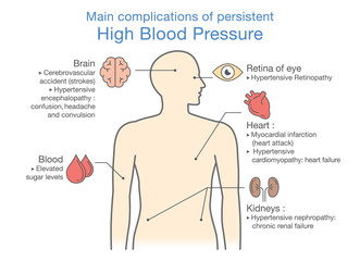 Main complications of persistent High Blood Pressure. Illustration about health and medical. - obrazy, fototapety, plakaty