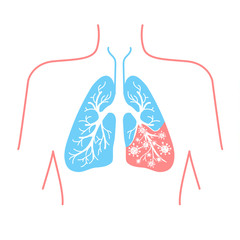 icon of lung disease pneumonia