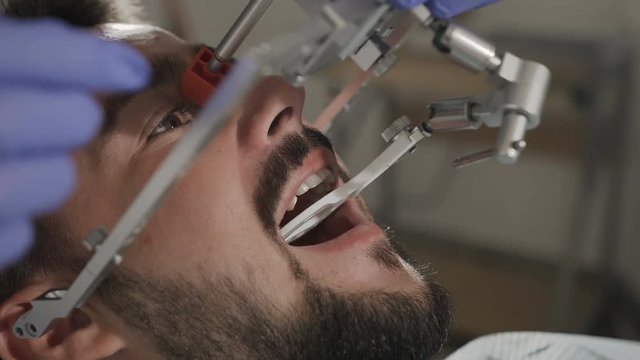 Installation of the face-bow. Modern technology. Dental clinic